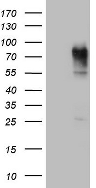CEACAM5 Antibody