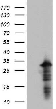 PRRX1 Antibody