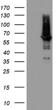 PDE1A Antibody