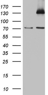 Melanoma gp100 Antibody