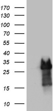 PRRX1 Antibody