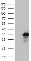 PRRX1 Antibody