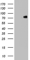 HNRPM Antibody
