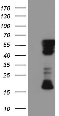 RIP3 Antibody