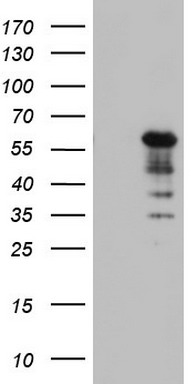 Cytokeratin 7 Antibody