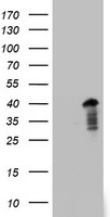 PRRX1 Antibody