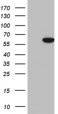Cytokeratin 7 Antibody