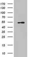 Cytokeratin 7 Antibody