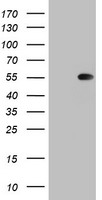 TIPIN Antibody