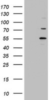 TIPIN Antibody