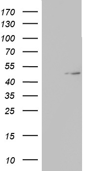 TIPIN Antibody