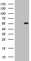 TIPIN Antibody