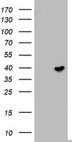 ETV7 Antibody