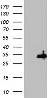 HADHSC Antibody