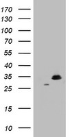 HADHSC Antibody