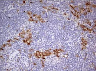 CD68 Antibody