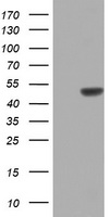 ZNF385B Antibody