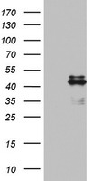 Ornithine Carbamoyltransferase Antibody