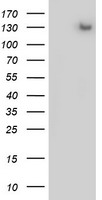 Progesterone Receptor Antibody