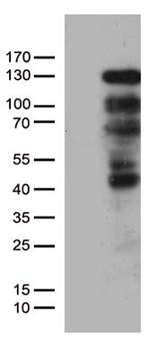Progesterone Receptor Antibody