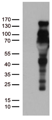 PGR Antibody