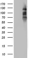 Progesterone Receptor Antibody