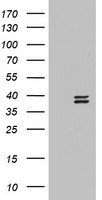 Ornithine Carbamoyltransferase Antibody