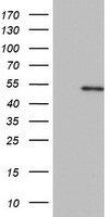 Cytokeratin 20 Antibody