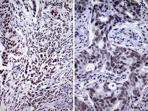 BRCA1 Antibody