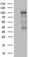 PGR Antibody