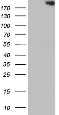 Topoisomerase II alpha Antibody