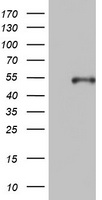 Cytokeratin 20 Antibody