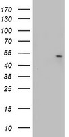 Cytokeratin 20 Antibody