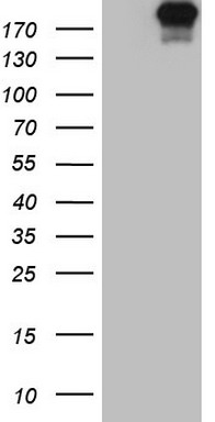 Topoisomerase II alpha Antibody