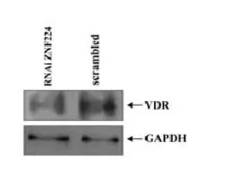 GAPDH antibody