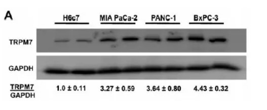 GAPDH antibody