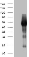 SPATA2L Antibody