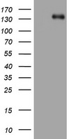 ZEB1 Antibody