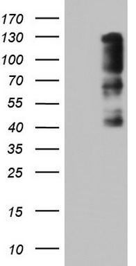 ZEB1 Antibody