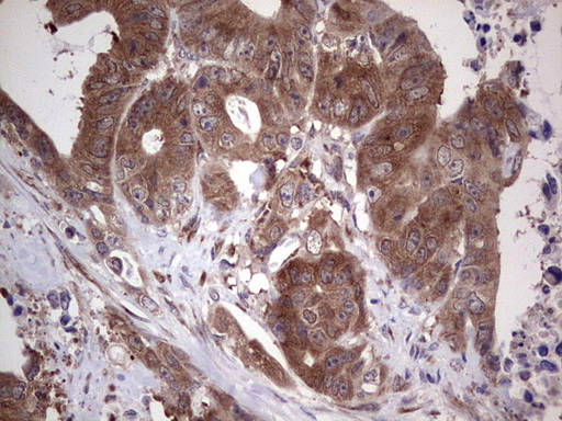 PIK3CA Antibody
