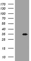 USP44 Antibody