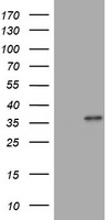 MUC16 Antibody
