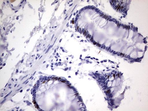 Ki67 Antibody