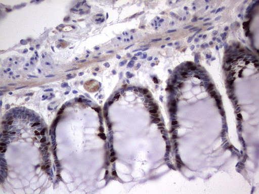 Ki67 Antibody