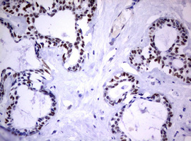 FOXP1 Antibody