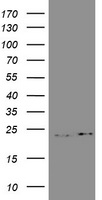 GSTP1 Antibody