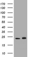 GSTP1 Antibody