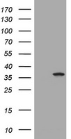 TYMS Antibody