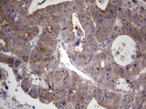 DICER1 Antibody