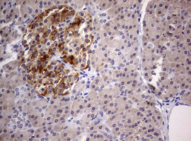 DICER1 Antibody